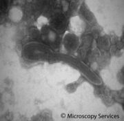 Negative Staining / Negativ Kontrastierung von Virusmaterial (Ebola-Virus) im TEM